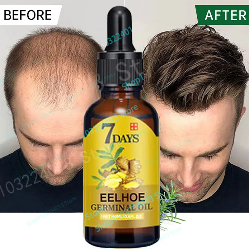 Fast Hair Growth Men Women Ginger Growth Hair Oil Treatment Anti Hair Loss Scalp Treatment Serum Products Beauty Health