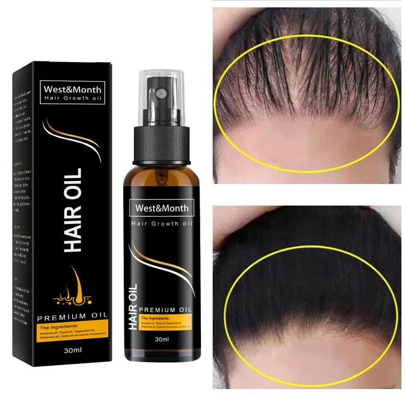 Fast Growing Hair Essential Oil Hair Growth Products Ginger Beauty Hair Care Men Women Prevent Hair Loss Oily Scalp Treatment