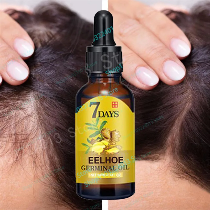 Fast Hair Growth Men Women Ginger Growth Hair Oil Treatment Anti Hair Loss Scalp Treatment Serum Products Beauty Health