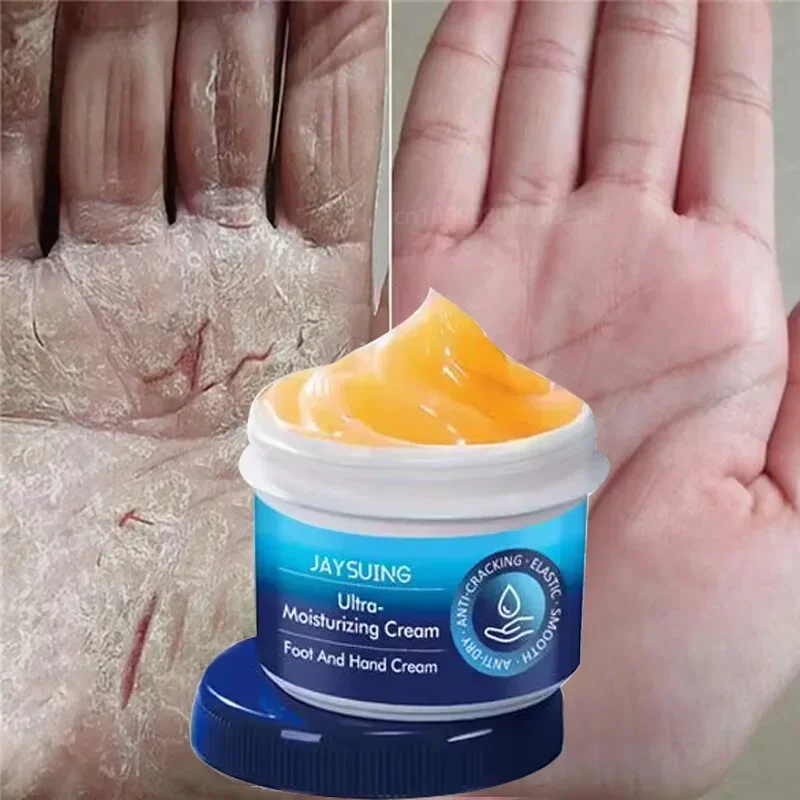 Hand Cream Beauty Health Body Lotion Crack Foot Hand Cream Heel Cracked Repair Hand Feet Mask Moisturizing Dead Skin Removal