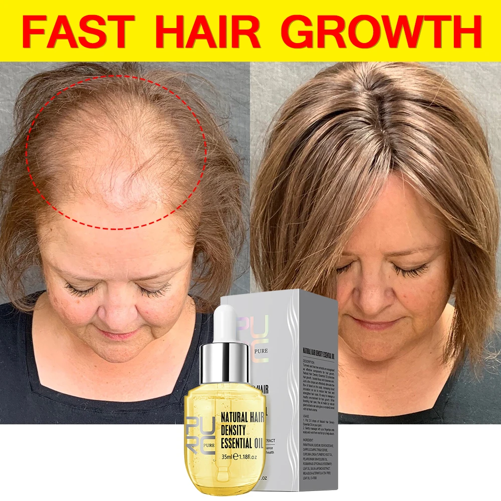 PURC Fast Hair Growth for Men Women Hair Oil Care Ginger Anti Hair Loss Scalp Treatment Grow Serum Products Beauty Health 35ml