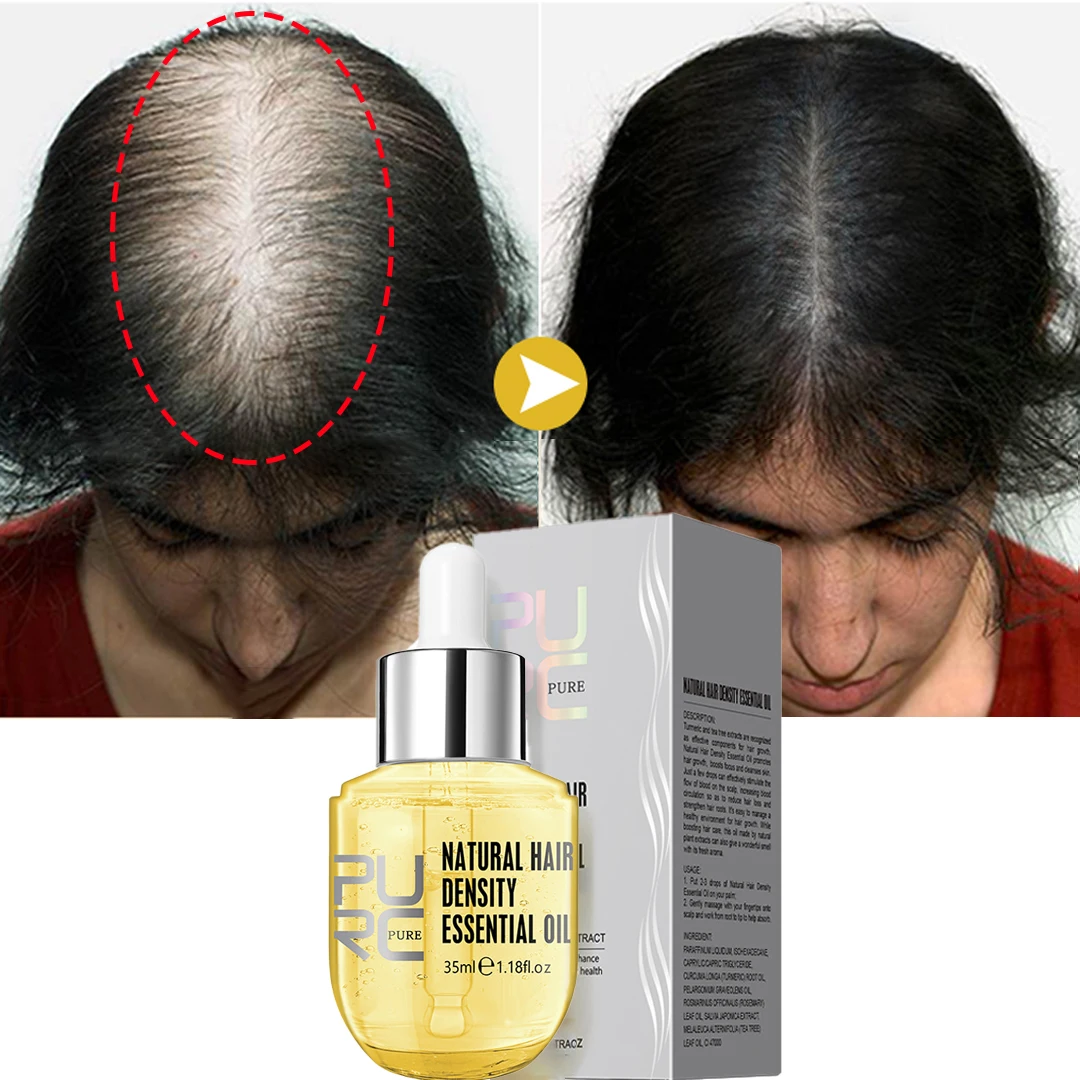 PURC Hair Growth Oil for Men Women Ginger Anti Hair Loss Care Fast Regrowth Thickener Scalp Treatment Hair Growth Products