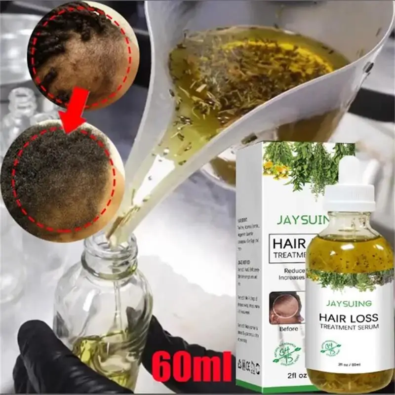 Rosemary Fast Hair Growth Essential Oil Anti Hair Loss Serum Scalp Treatment Serum For Men Women Beauty Health Products 60ML