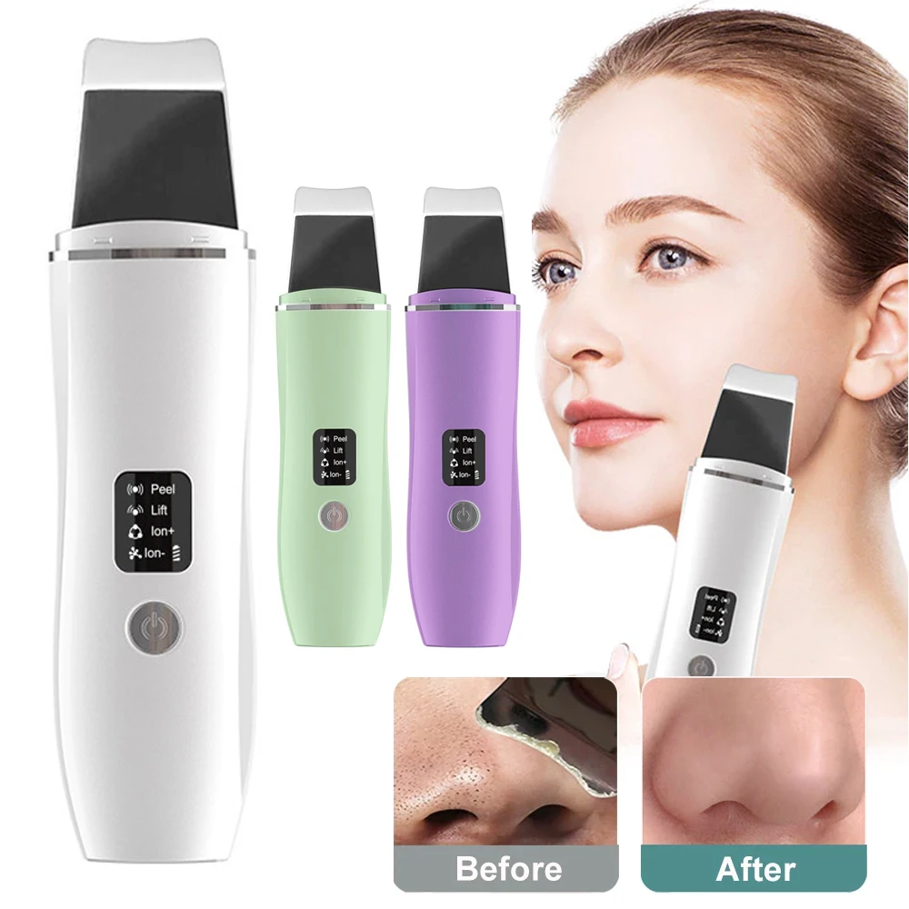 Ultrasonic Skin Scrubber Peeling Blackhead Remover Deep Face Cleaning Ultrasonic Ion Cleaner Facial Beauty Face Cleaner