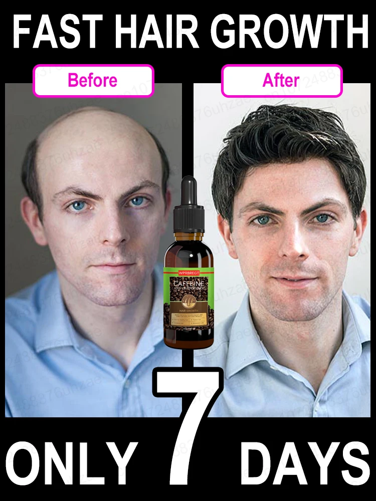 Unisex Hair Growth Oil Hair Loss Treatment Rapid Hair Growth Effective Baldness Repair Hereditary Postpartum