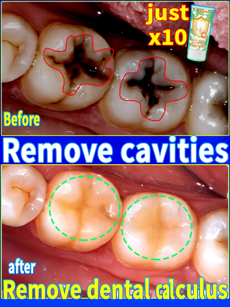 whiten enamel,Clean cavities, remove plaque, treat periodontitis, freshen breath